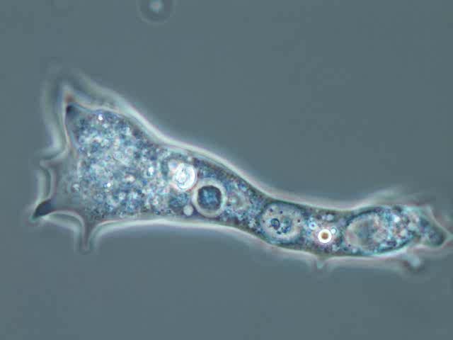 amoeba-proteus-thumbnail